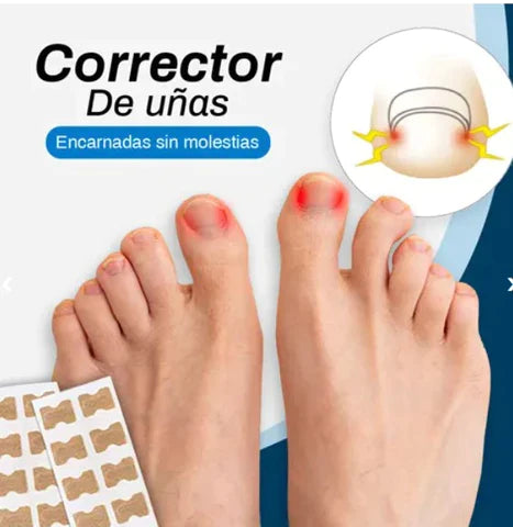 NAILPATCH™ - PARCHES PARA UÑAS Y HONGOS