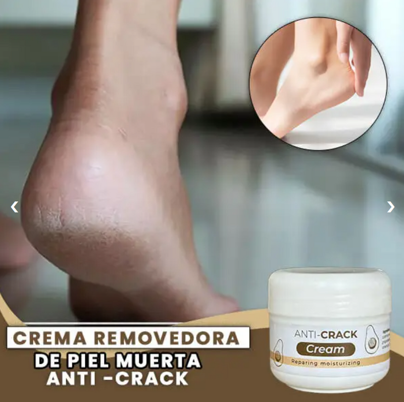 Anti-Crack Cream™ Hidrata profundamente