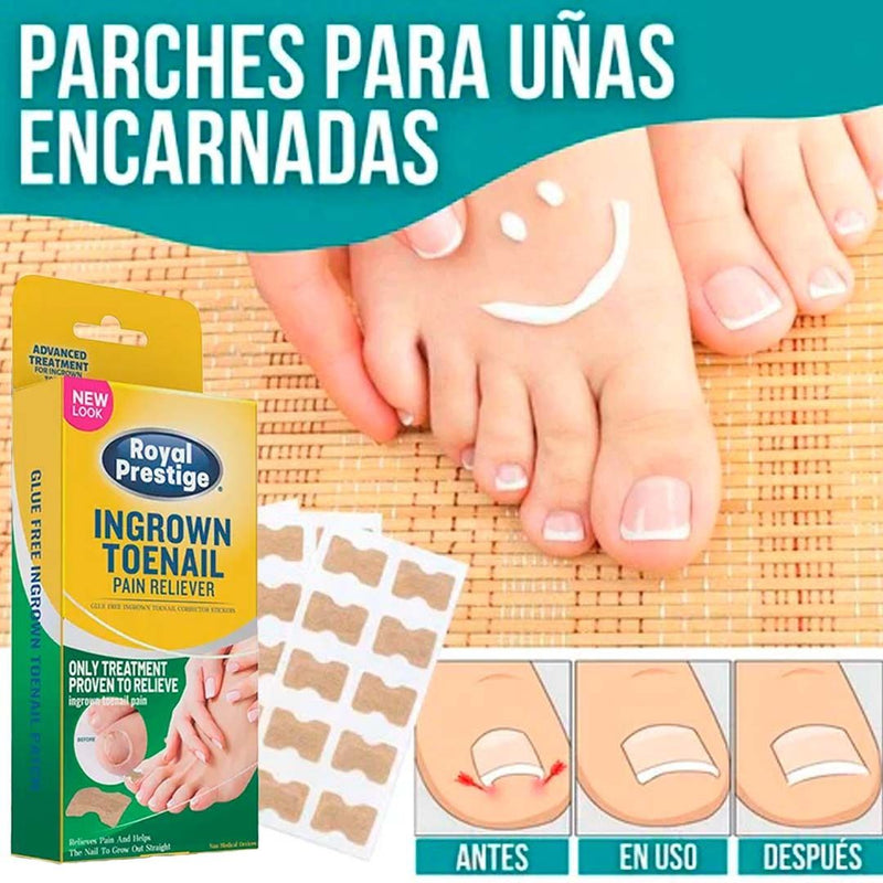 NAILPATCH™ - PARCHES PARA UÑAS Y HONGOS