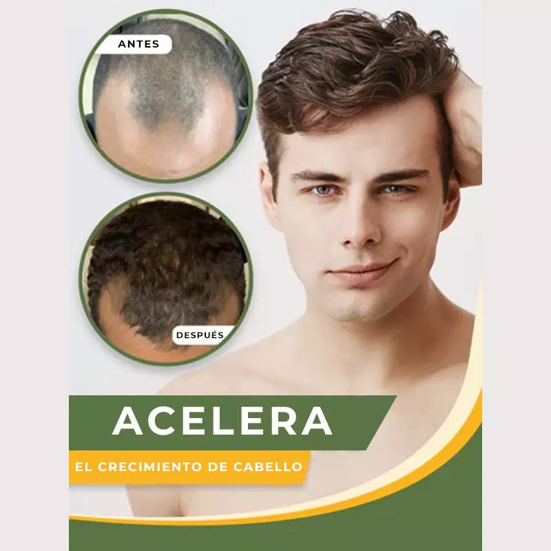 SUERO PARA CABELLO™- Crecimiento Capilar