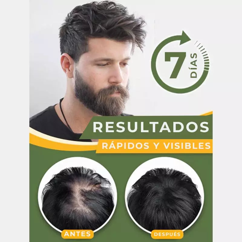 SUERO PARA CABELLO™- Crecimiento Capilar